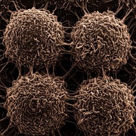 Illustrative render of macrophages: rounded, ruffled immune cells